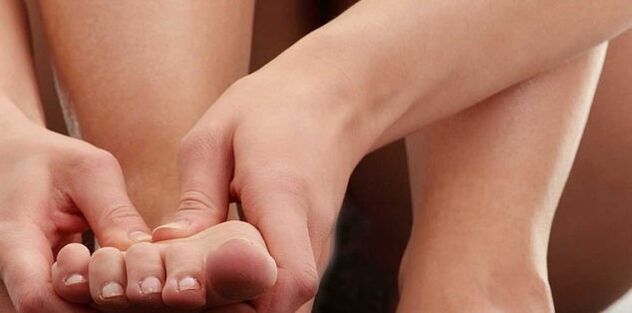 diet for gout